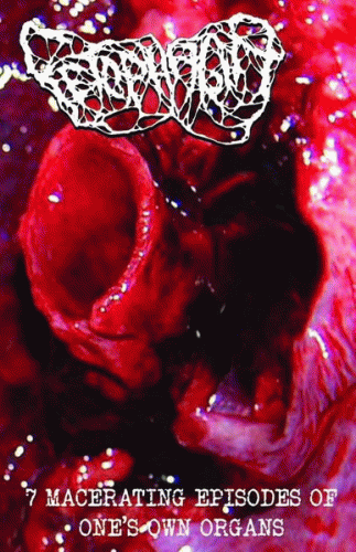 7 Macerating Episodes of One’s Own Organs